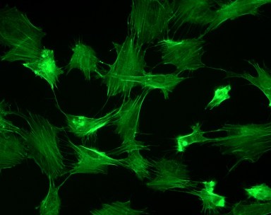 fibroblasts