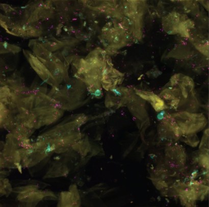 Skin Fungal Diversity